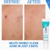 Cerave Blemish Control Gel 40ml