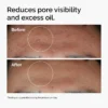 before and after by using The Ordinary Niacinamide 10% + Zinc 1%