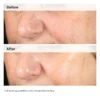 The Ordinary Alpha Arbutin 2% + HA Serum 30ml – Miyar Mart