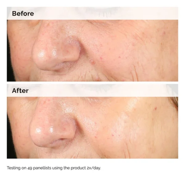 The Ordinary Alpha Arbutin 2% + HA Serum 30ml – Miyar Mart